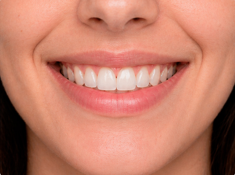 GINGIVAL-2